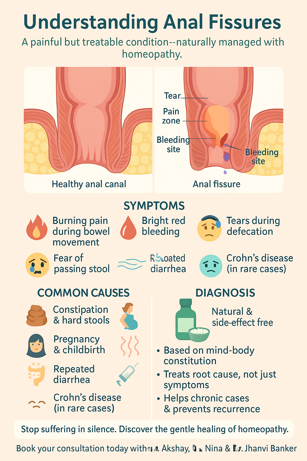 Anatomical diagram of an anal fissure illustrating the location of the tear, potential causes, and symptoms like pain during bowel movements.